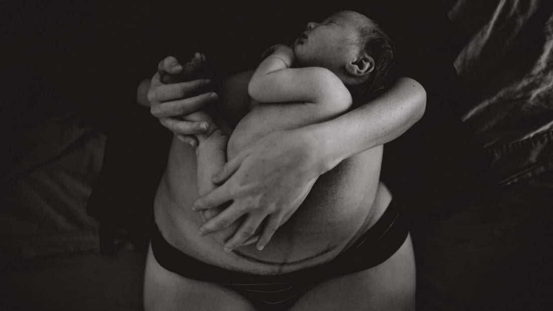 C-Section Scar Massage: Why it’s important and how to do it
