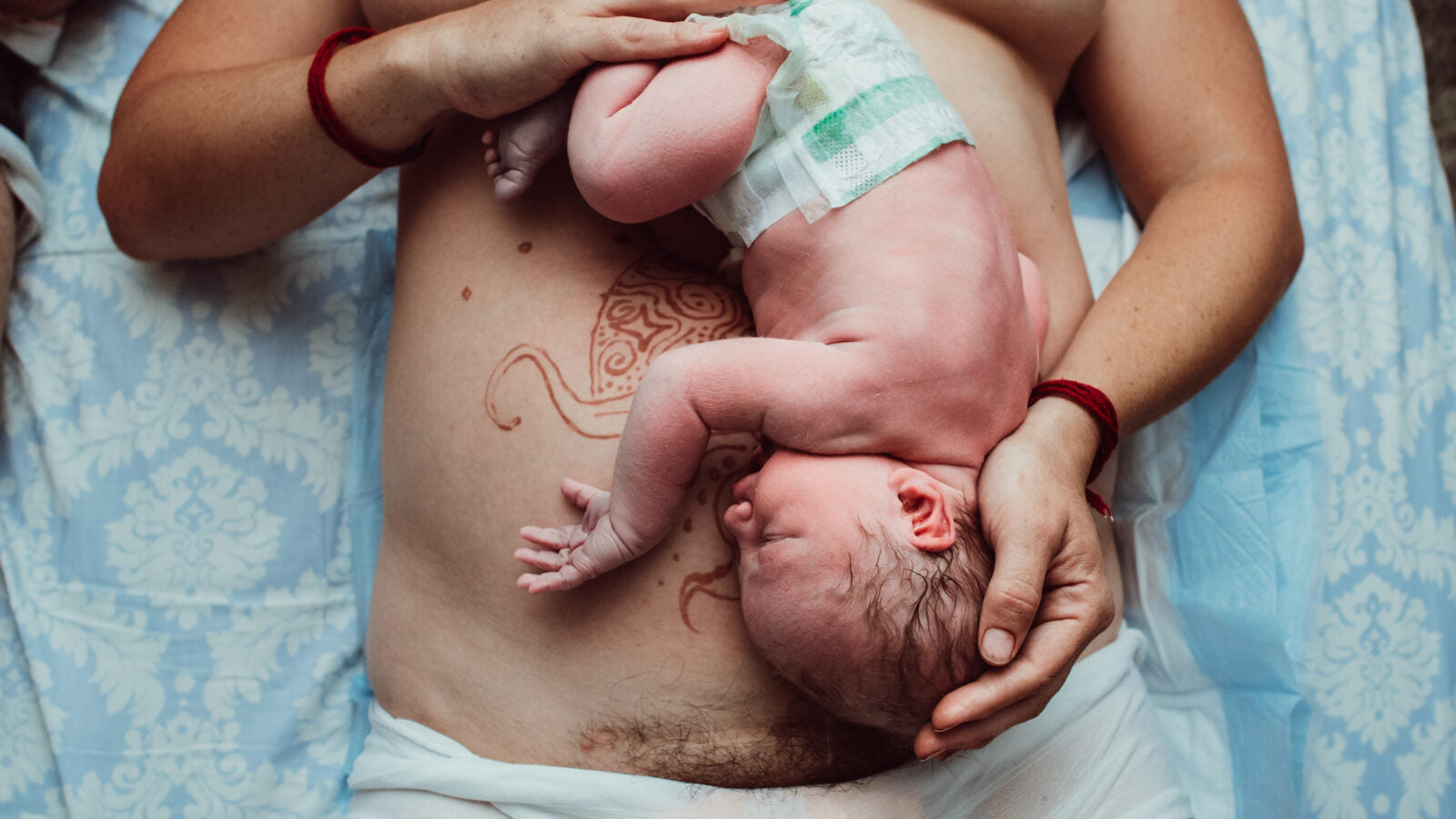 ECV and VBAC: What You Need to Know