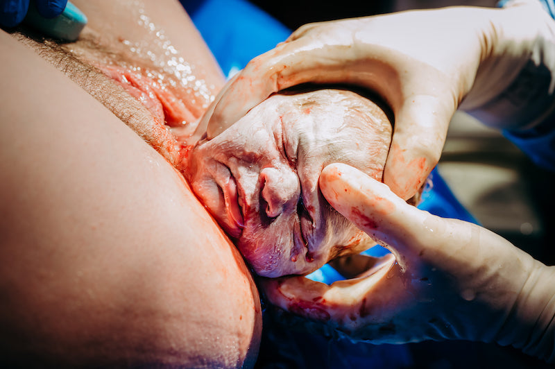 The Risks of Uterine Rupture During VBAC or HBAC and How to Reduce Them