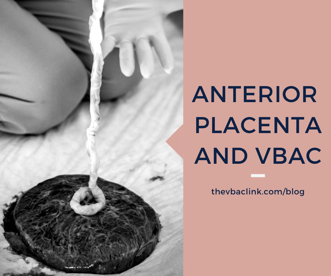 Anterior Placenta and VBAC